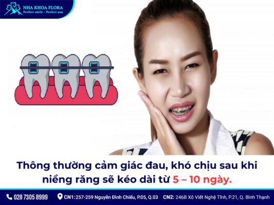 niềng răng bao lâu thì hết đau - ảnh 1 niềng răng bao lâu thì hết đau - ảnh 1