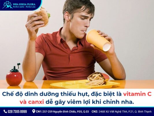 niềng răng bị sưng lợi - ảnh 3 niềng răng bị sưng lợi - ảnh 3