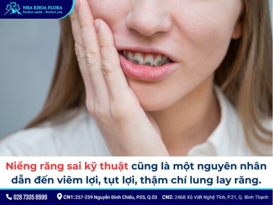niềng răng bị sưng lợi - ảnh 4 niềng răng bị sưng lợi - ảnh 4