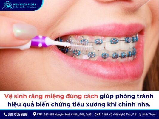 niềng răng bị tiêu xương - ảnh 6 niềng răng bị tiêu xương - ảnh 6
