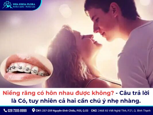 niềng răng có hôn nhau được không - ảnh 1 niềng răng có hôn nhau được không - ảnh 1