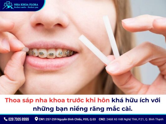 niềng răng có hôn nhau được không - ảnh 3 niềng răng có hôn nhau được không - ảnh 3