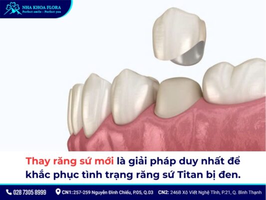 răng sứ Titan có bị đen không - ảnh 4 răng sứ Titan có bị đen không - ảnh 4