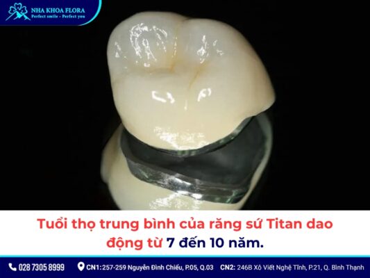 răng sứ Titan sử dụng được bao lâu - ảnh 1 răng sứ Titan sử dụng được bao lâu - ảnh 1