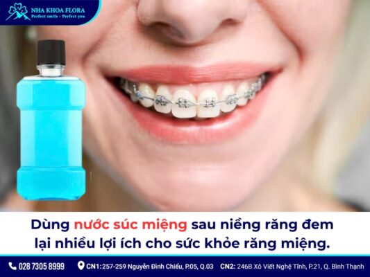 sau khi niềng răng - ảnh 4 sau khi niềng răng - ảnh 4