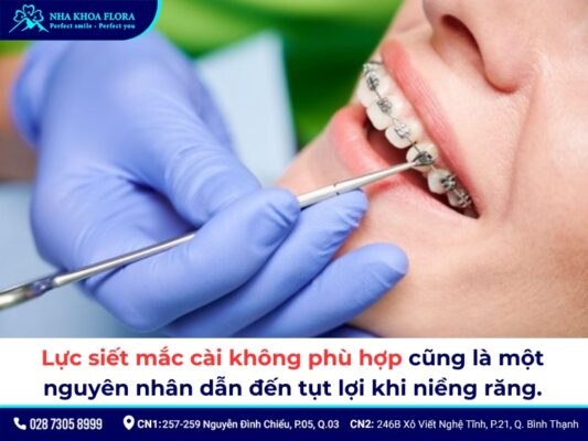 tụt lợi khi niềng răng - ảnh 5 tụt lợi khi niềng răng - ảnh 5