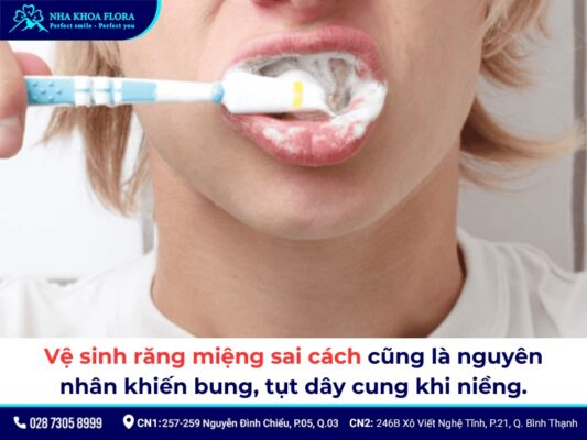 đứt dây cung niềng răng - ảnh 3 đứt dây cung niềng răng - ảnh 3