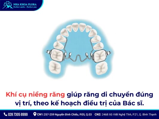 khí cụ niềng răng - ảnh 1 khí cụ niềng răng - ảnh 1