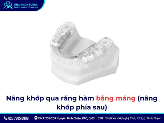 nâng khớp cắn niềng răng - ảnh 5 nâng khớp cắn niềng răng - ảnh 5