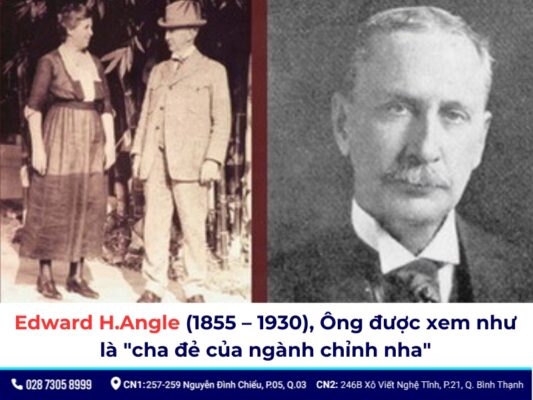 niềng răng thời xưa - ảnh 3 niềng răng thời xưa - ảnh 3