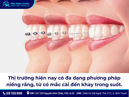 niềng răng thời xưa - ảnh 6 niềng răng thời xưa - ảnh 6