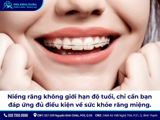 niềng răng thời xưa - ảnh 7 niềng răng thời xưa - ảnh 7