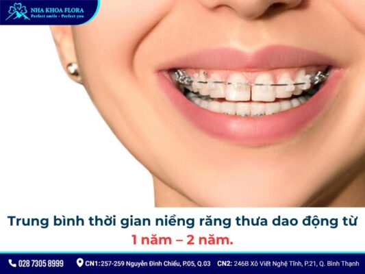 niềng răng thưa - ảnh 3 niềng răng thưa - ảnh 3