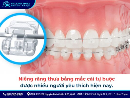 niềng răng thưa - ảnh 4 niềng răng thưa - ảnh 4