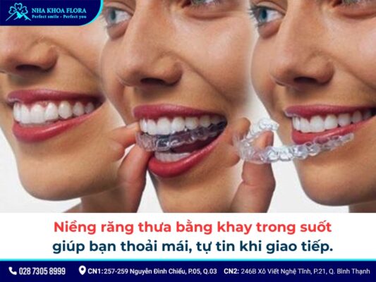 niềng răng thưa - ảnh 5 niềng răng thưa - ảnh 5