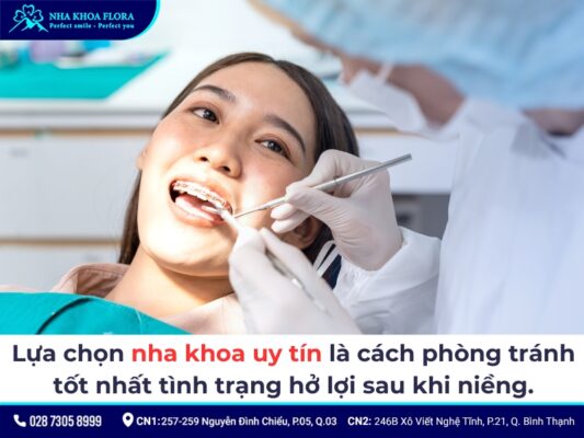niềng răng xong bị cười hở lợi - ảnh 5 niềng răng xong bị cười hở lợi - ảnh 5