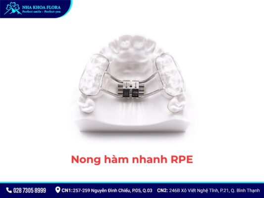 nong hàm niềng răng - ảnh 3 nong hàm niềng răng - ảnh 3