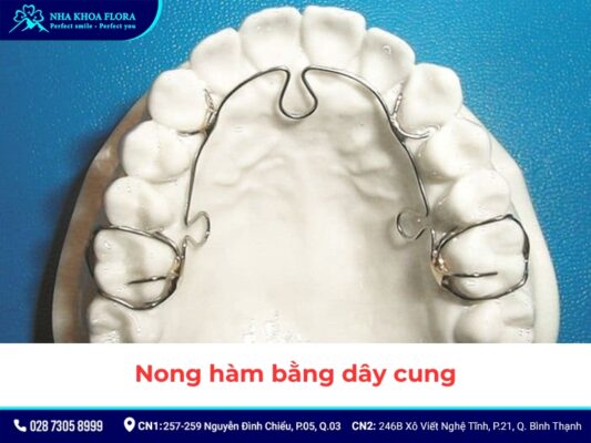 nong hàm niềng răng - ảnh 4 nong hàm niềng răng - ảnh 4