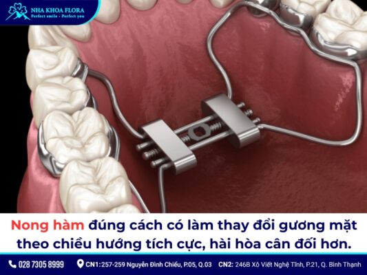 nong hàm niềng răng - ảnh 5 nong hàm niềng răng - ảnh 5