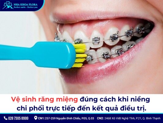 cách dùng chỉ nha khoa khi niềng răng - ảnh 1 cách dùng chỉ nha khoa khi niềng răng - ảnh 1