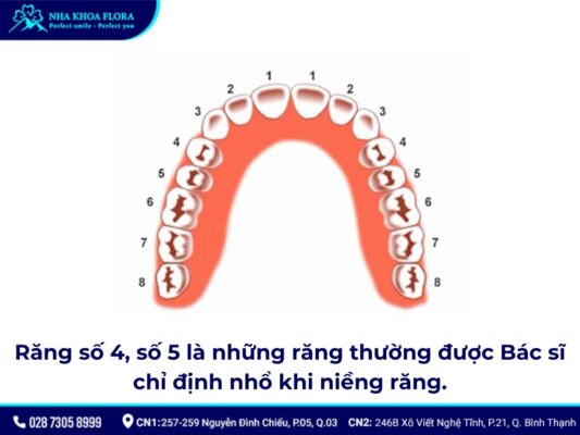 nhổ 4 răng để niềng răng - ảnh 2 nhổ 4 răng để niềng răng - ảnh 2