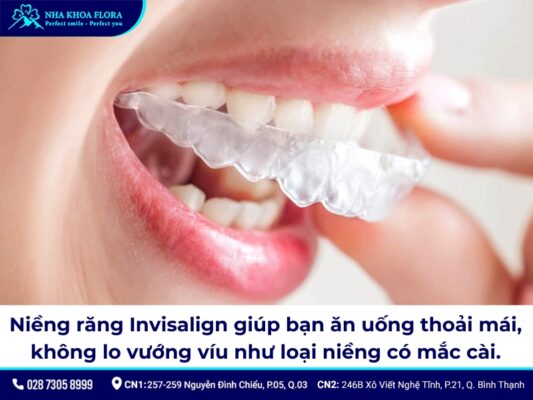 niềng răng bao lâu thì ăn được cơm - ảnh 4 niềng răng bao lâu thì ăn được cơm - ảnh 4