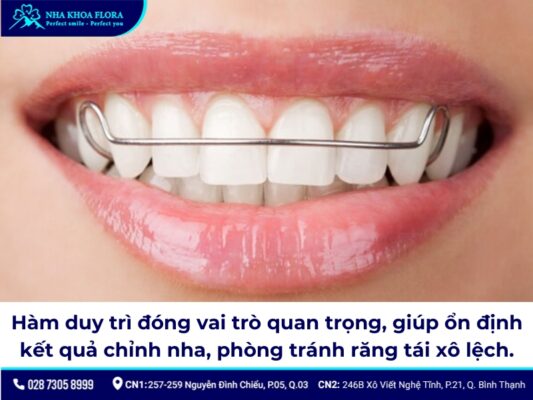 niềng răng có bị hô lại không - ảnh 2 niềng răng có bị hô lại không - ảnh 2