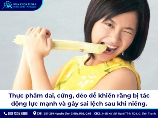 niềng răng có bị hô lại không - ảnh 3 niềng răng có bị hô lại không - ảnh 3
