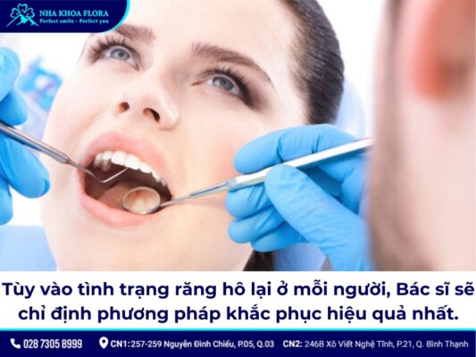 niềng răng có bị hô lại không - ảnh 5 niềng răng có bị hô lại không - ảnh 5