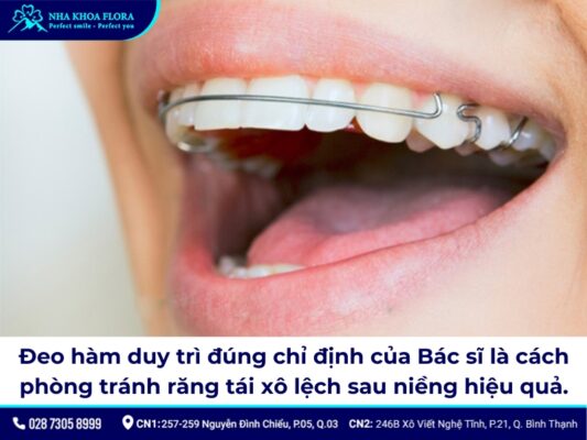 niềng răng có bị hô lại không - ảnh 6 niềng răng có bị hô lại không - ảnh 6