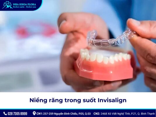 niềng răng có được vĩnh viễn không - ảnh 5 niềng răng có được vĩnh viễn không - ảnh 5