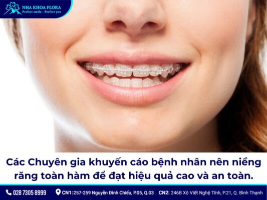 niềng răng cửa thưa - ảnh 1 niềng răng cửa thưa - ảnh 1