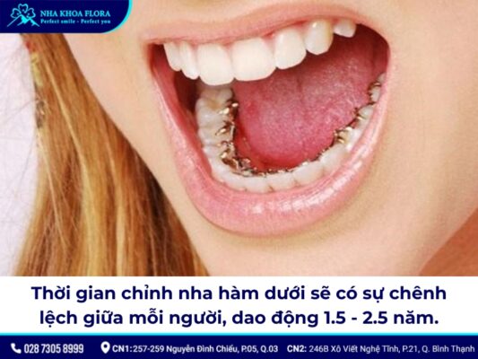 niềng răng hàm dưới - ảnh 3 niềng răng hàm dưới - ảnh 3