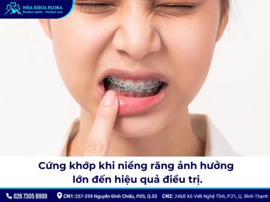 tác hại của niềng răng - ảnh 4 tác hại của niềng răng - ảnh 4