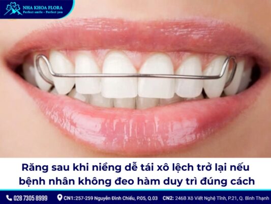 tác hại của niềng răng - ảnh 5 tác hại của niềng răng - ảnh 5