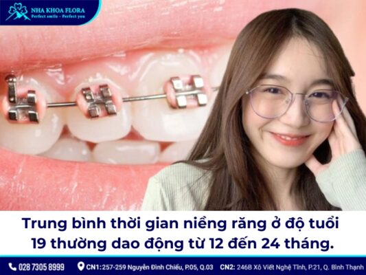 19 tuổi niềng răng bao lâu - ảnh 1 19 tuổi niềng răng bao lâu - ảnh 1