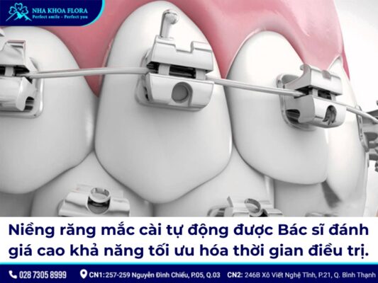 19 tuổi niềng răng bao lâu - ảnh 2 19 tuổi niềng răng bao lâu - ảnh 2