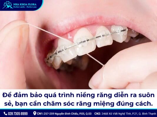 19 tuổi niềng răng bao lâu - ảnh 4 19 tuổi niềng răng bao lâu - ảnh 4