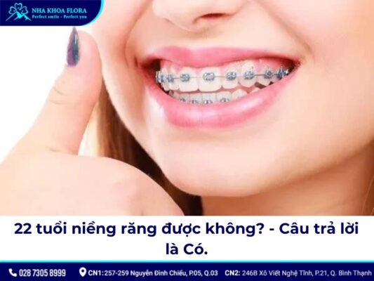22 tuổi niềng răng được không? - ảnh 2 22 tuổi niềng răng được không? - ảnh 2