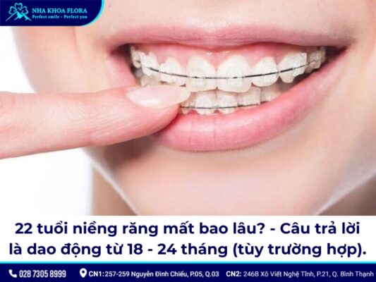 22 tuổi niềng răng được không? - ảnh 3 22 tuổi niềng răng được không? - ảnh 3