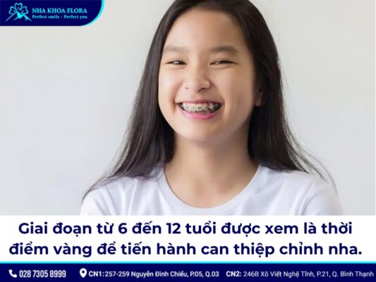 25 tuổi niềng răng được không - ảnh 1 25 tuổi niềng răng được không - ảnh 1