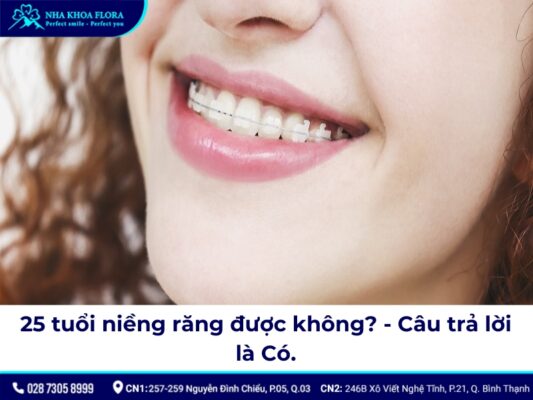 25 tuổi niềng răng được không - ảnh 2 25 tuổi niềng răng được không - ảnh 2