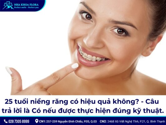 25 tuổi niềng răng được không - ảnh 3 25 tuổi niềng răng được không - ảnh 3