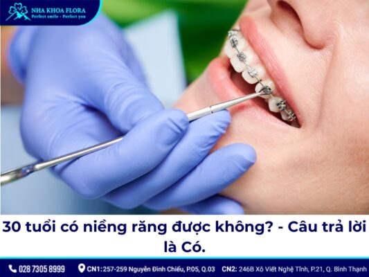 30 tuổi có niềng răng được không - ảnh 1 30 tuổi có niềng răng được không - ảnh 1