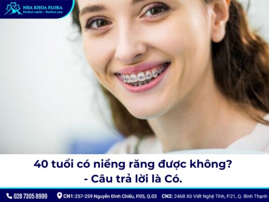 40 tuổi có niềng răng được không - ảnh 1 40 tuổi có niềng răng được không - ảnh 1
