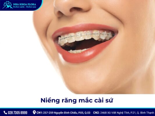 40 tuổi có niềng răng được không - ảnh 4 40 tuổi có niềng răng được không - ảnh 4