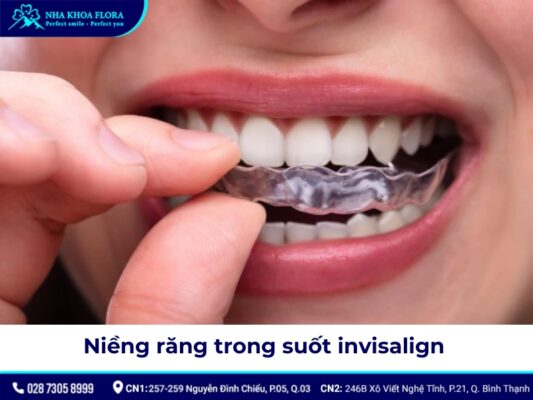 40 tuổi có niềng răng được không - ảnh 5 40 tuổi có niềng răng được không - ảnh 5