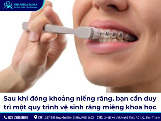 đóng khoảng trong niềng răng – ảnh 7 đóng khoảng trong niềng răng – ảnh 7