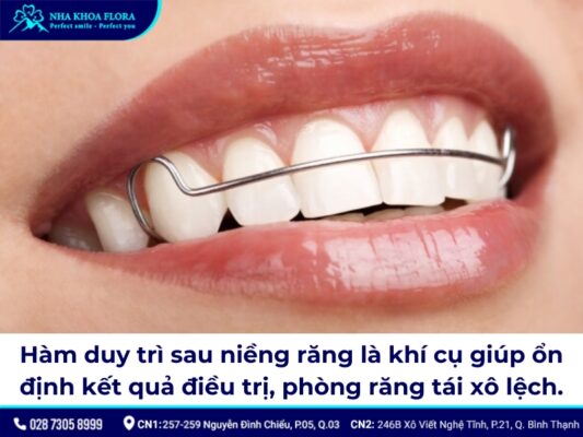 hàm duy trì sau niềng răng - ảnh 1 hàm duy trì sau niềng răng - ảnh 1
