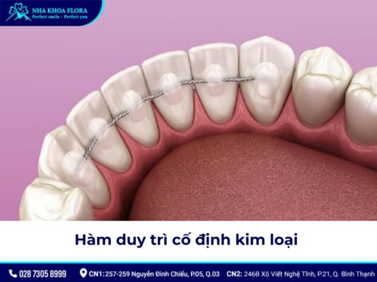 hàm duy trì sau niềng răng - ảnh 4 hàm duy trì sau niềng răng - ảnh 4